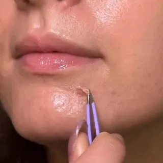 Never letting my pimple get in the way of plans😌🙅‍♀️