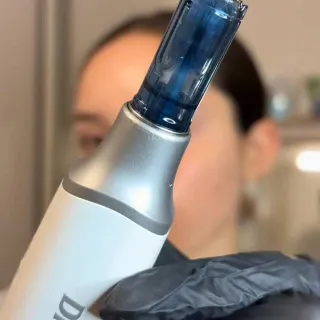 The Dr. Pen M9 era has begun.⁠
⁠
Are you ready to take your skincare to the next level?⁠

🎥Video credit to Albesole
⁠
#microneedling #skintech #skincare #antiaging #glowingskin⁠ 
⁠
⁠
⁠