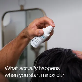 Transformation starts with intention and is executed through consistency.

When you stick to something and see results, confidence follows.

Start the process with INTELLIGENT Minoxidil.