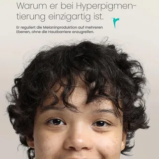 Dunkle Flecken, die einfach nicht verschwinden wollen. 👀

Der Pigment Control Booster wirkt dort, wo andere Produkte aufhören, direkt an der Entstehung von Pigmentflecken. Sanft zur Haut, konsequent i