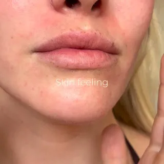 Is your skin showing signs of stress? 

Our Ageless Even Glow is formulated with Niacinamide, which acts as a calming and repairing agent, helping the skin recover from environmental, physical, and ch