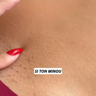 On mérite toutes un rasage sans douleur et une peau incroyablement lisse, même sur les zones les plus délicates.

🚫 Zéro coupure
🚫 Zéro irritation
🚫 Zéro rougeur

🎁 PROFITE DE -50% AUJOURD'HUI !
Lien 
