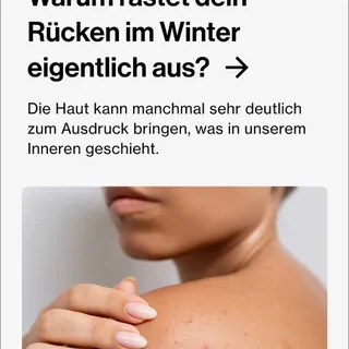 Pickel am Rücken im Winter? So bleibst du möglichst pickelfrei ❄️✨

1. Atmungsaktive Kleidung (Baumwolle/Leinen)
2. Heizungsluft = trocken: gut eincremen
3. Salicylsäure oder BPO-Waschgel zur Reinigun