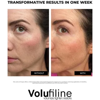 BLACK FRIDAY DEALS ARE LIVE TODAY ONLY! ✨

✅ Buy 2, Get 1 Free
✅ Free Booster Cream ($29 value)
✅ 10% Off On All Products

Volufiline has been called “filler in a bottle” for its ability to visibly pl