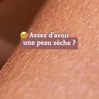 Assez d’avoir une sensation de peau qui tire ? 

Découvrez notre indispensables pour les peaux sèches : le savon à l’huile de Bourrache 💖

✅ Un surgras de 5% pour une peau nourrie
✅ L’huile de Bourrac