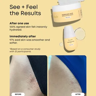 POV: you finally found the routine that actually works 🍯✨ Milk & Honey 2-Step Ingrown Hair Routine did NOT miss. Smooth skin szn is here and she’s staying.