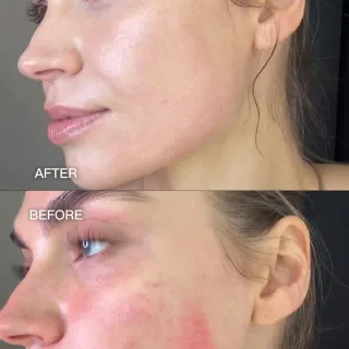 from flush to calm 🍵
the TIRTIR matcha line helps soothe visible redness, hydrate, and bring skin back to balance.

#TIRTIR #TIRTIRskincare #CalmingMatcha #TIRTIRMATCHA #MatchaPDRN