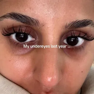 Volufiline works deep in the skin to enhance curves, fullness, and plumpness naturally. Apply daily and watch your skin become more voluminous and youthful with results that last.